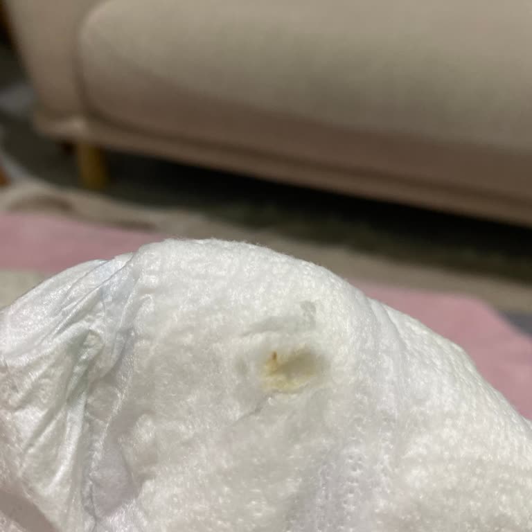 Molfix 4 Numaralı Bebek Bezinde Sarı Katı Yabancı Madde