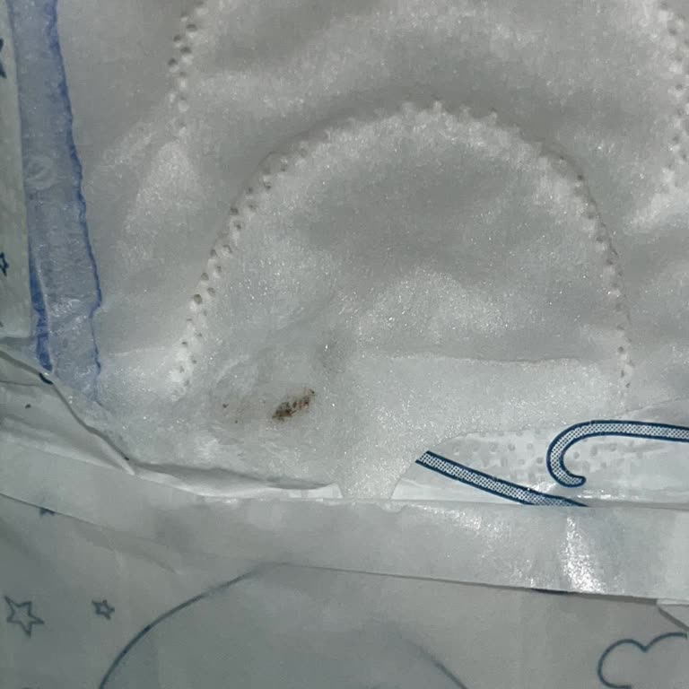 Molped Gece Pedde Kahverengi Leke: Hijyen Sorunu Ve İade Talebi