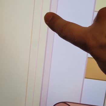 Philips Ambilight Televizyonumda Tekrar Eden Ekran Arızası Ve Servis Süreci Para İadesi Talebi