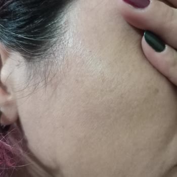 Bioderma Photoderm Aquafluide 50 Ürünü Ciltte Pütürlenme Ve Kalıcı Lekeler Oluşturdu