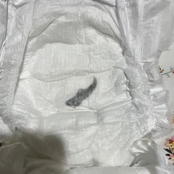 Molfix Bebek Bezinde Yabancı Madde Ve Şiddetli Sızma Problemleri