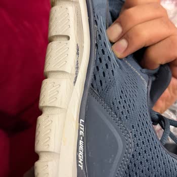 Skechers Ayakkabılarda Ön Burun Açılması Ve Üretim Hatası İddiası