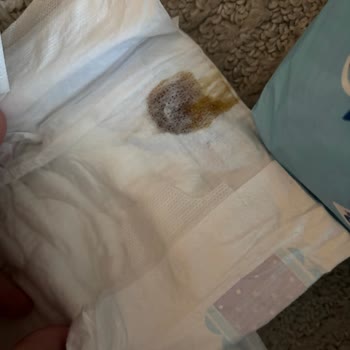 Molfix Bebek Bezi İçindeki Kahverengi Madde Hijyen Endişesi