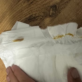 Molfix Junior Bebek Bezinde Üretim Hatası Ve Müşteri Desteği Eksikliği