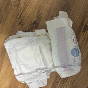 Molfix Junior Bebek Bezinde Üretim Hatası Ve Müşteri Desteği Eksikliği