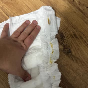 Molfix Junior Bebek Bezinde Üretim Hatası Ve Müşteri Desteği Eksikliği