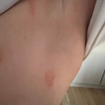 Dikiş Kalitesi Yüzünden Cilt Tahrişi Firmadan Cevap Yok İade Bekliyor