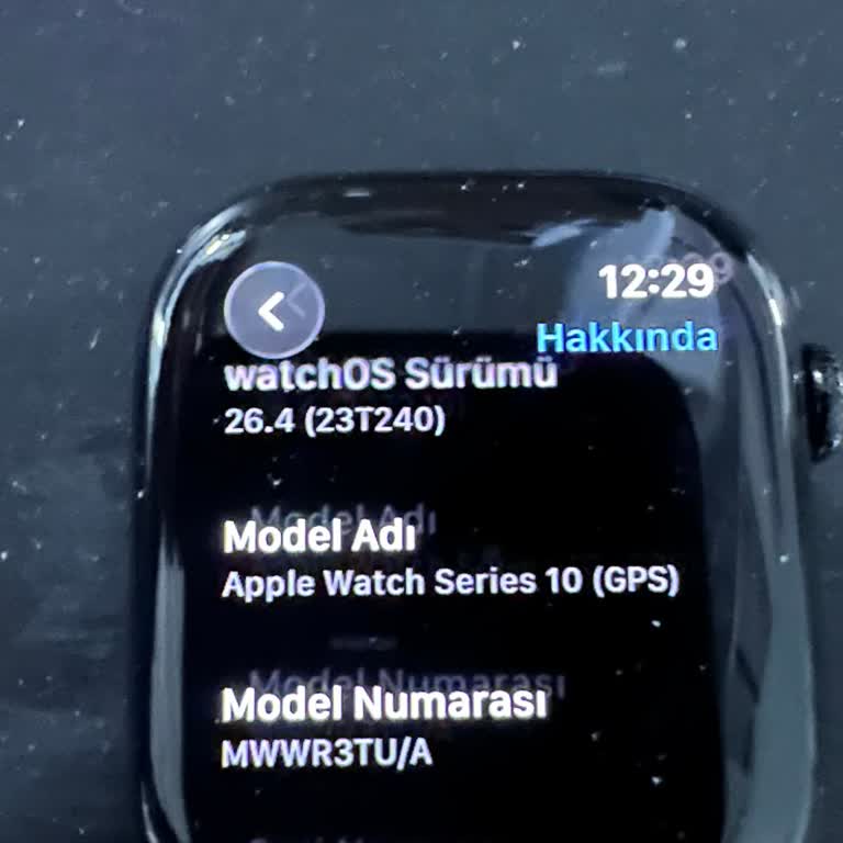 Apple Watch 11 Alındı, Apple Watch 10 Verildi: Hatalı Ürün Ve Uzun Bekleme