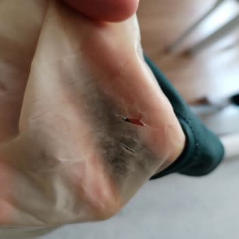 Satıcı Kusurlu Çocuk Trençkotunu Reddetti Ve Hesabını Kapatıp Ücret İadesini Engelledi