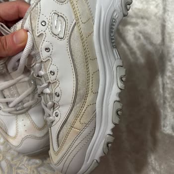 Skechers D'Lites Ayakkabısının Kısa Sürede Sararması Ve Kullanılamaz Hale Gelmesi