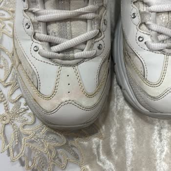 Skechers D'Lites Ayakkabısının Kısa Sürede Sararması Ve Kullanılamaz Hale Gelmesi