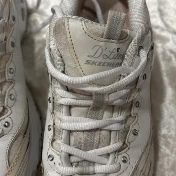 Skechers D'Lites Ayakkabısının Kısa Sürede Sararması Ve Kullanılamaz Hale Gelmesi