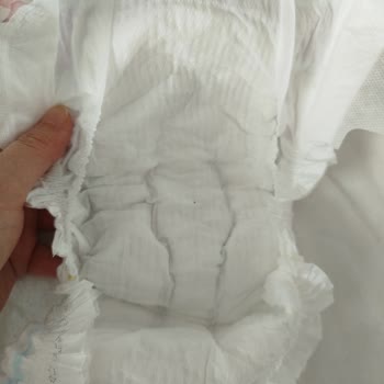 Molfix Maxi Bezlerinde Sertlik Ve Sızdırma Sorunu