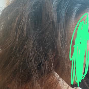 Beyaz Köşk Kuaförde 3.500 TL’lik Saç Işıltı Ve Bakım İşlemi Beklenen Sonucu Vermedi
