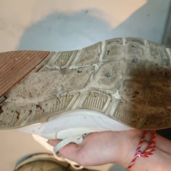 Skechers Ayakkabıda Erime Ve Yırtılma, Mağaza Kullanıcı Hatası Söylüyor