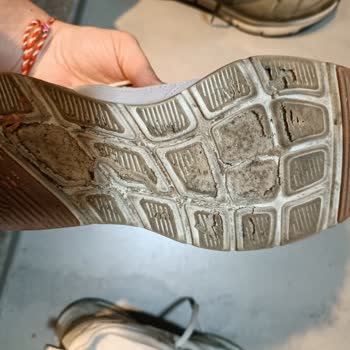 Skechers Ayakkabıda Erime Ve Yırtılma, Mağaza Kullanıcı Hatası Söylüyor