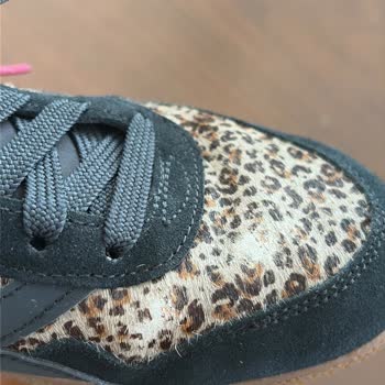 Puma Ayakkabısının Kısa Sürede Deri Dökülmesi Kullanıcı Hatası Olarak Kabul Edilemez