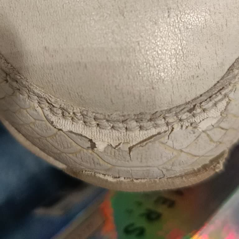 Skechers Ayakkabısının Deri Soyulması Ve Haksız İade Reddi