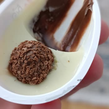 Kinder Sürpriz Yumurtasında Kıl Bulunması Ve Hijyen Sorunu