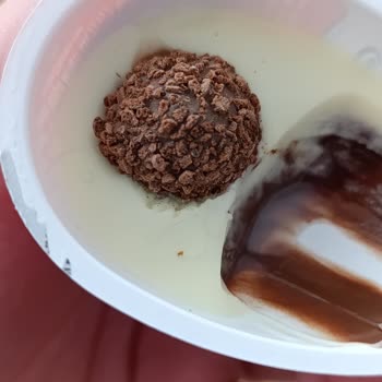 Kinder Sürpriz Yumurtasında Kıl Bulunması Ve Hijyen Sorunu