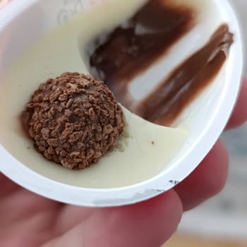 Kinder Sürpriz Yumurtasında Kıl Bulunması Ve Hijyen Sorunu