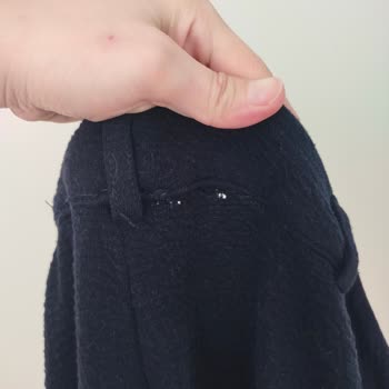 Jimmy Key Pantolonunun Belinde Yırtılma, Kalite Güvenim Sarsıldı