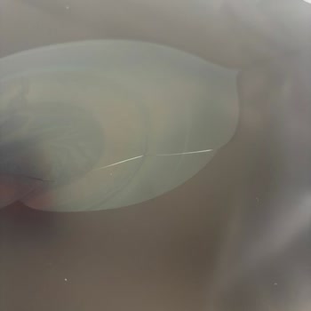 Kırık Monitörüm İçin Uzun İade Süreci Ve Tüketici Hakları İhlali