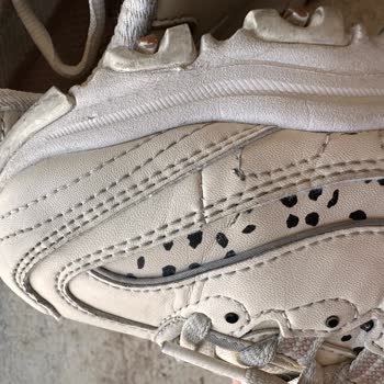 Skechers Ayakkabımda Kısa Sürede Yırtılma Ve Deformasyon: Üretim Sorunu Ve Yetersiz İnceleme