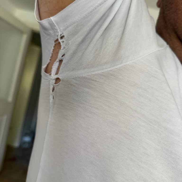 Kısa Sürede Yırtılan T-Shirt İçin Ayıplı Ürün Şikayeti