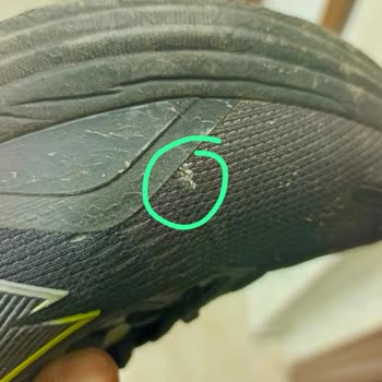 İki Ayakkabıda Aynı File Yırtılması Ve Mağazanın Sorumluluğu Reddetmesi