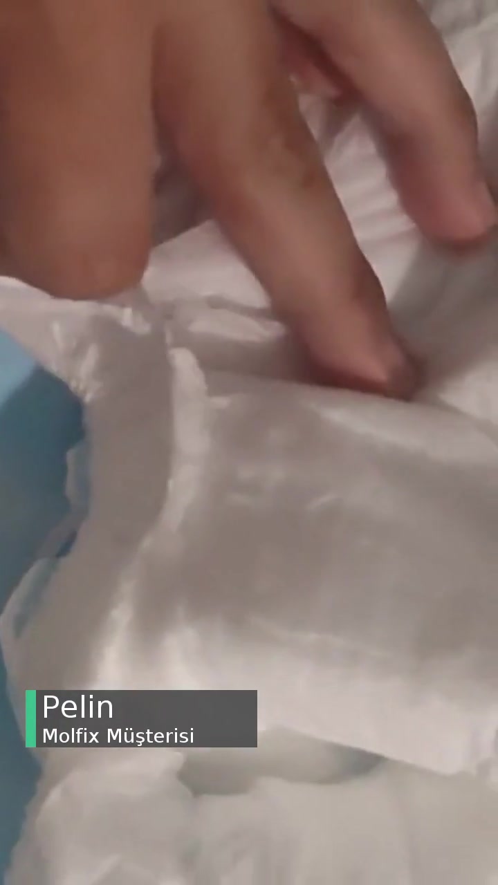 Molfix Bezlerin Yapışması Yüzünden Yırtılması videonun kapak resmi