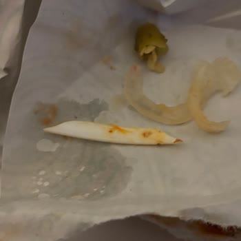 Sağlık Riski Taşıyan Plastik Parçalı Döner Ve Yorumun Keyfi Gizlenmesi