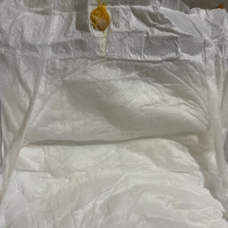 Sleepy Natural Bebek Bezinde Sarı Lekeli Ürünler Hijyen Endişesi