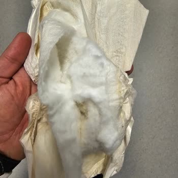 Yırtılmış Ve Kötü Kokulu Yenidoğan Bezleri İçin İade Şikayeti