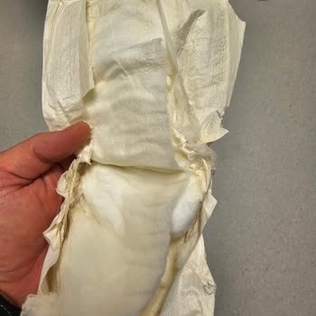 Yırtılmış Ve Kötü Kokulu Yenidoğan Bezleri İçin İade Şikayeti