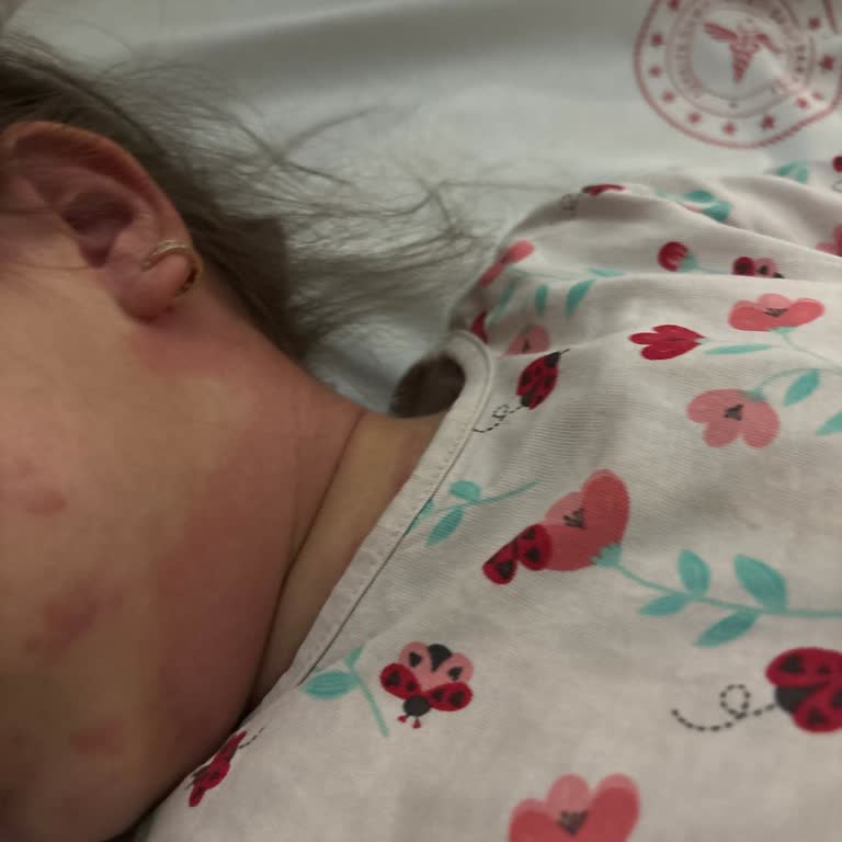 İburamin Zero Alerjik Reaksiyonu Sonrası Çocuğum Hastanede Üretici İncelemesi Talebi