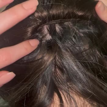 Rönesans Peruka’da Hatalı Kaynak Ve Boncuklar Nedeniyle Saçta Ağrı Ve Telafi Talebi