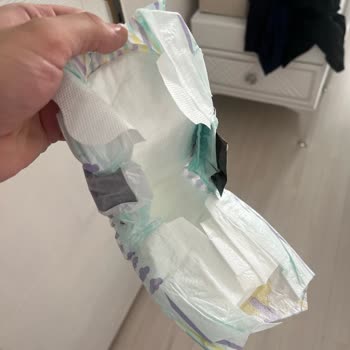 Jenny&Willy Bebek Bezlerinde Hatalı Baskı Ve Hijyen Sorunu