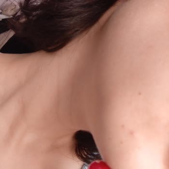 Ürün Kullanımı Sonrası Sivilce Artışı