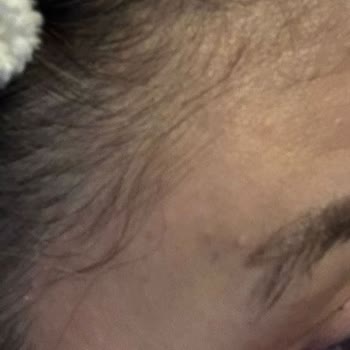 Microblading Sonrası Dövme Görüntüsü Ve İlgisiz Müşteri Hizmeti