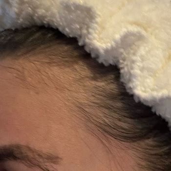 Microblading Sonrası Dövme Görüntüsü Ve İlgisiz Müşteri Hizmeti