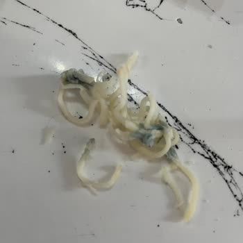 Küflü Mozzarella Peyniri Satın Alındı Ve Sağlık Riski