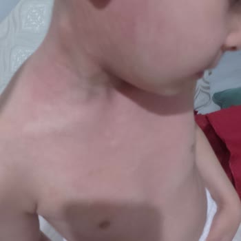 BİM Şubesinde Son Kullanma Tarihi Yakın Ürün Satışı Çocuğumda Alerjik Kriz