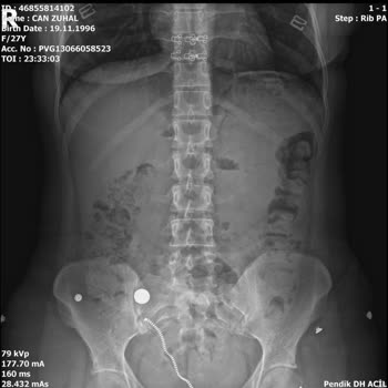 Aksigorta’nın Önceden Var Olan Hastalık Gerekçesiyle Fizik Tedavi Provizyonumun Reddedilmesi