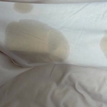 Ayıplı Bebek Bezi Sızdırma Sorunu Ve Ücret İadesi Talebi