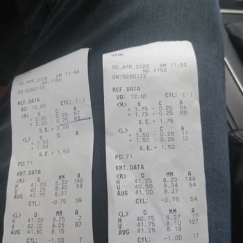 Yanlış Göz Reçetesi Ve Doktorun Kaba Davranışı Görme Bozukluğuna Yol Açtı