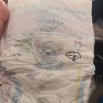 Molfix 3 Numaralı Bebek Bezinde Şiddetli Koku Sorunu