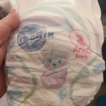 Molfix 3 Numaralı Bebek Bezinde Şiddetli Koku Sorunu