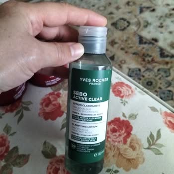 Yves Rocher Creams Caused Eczema