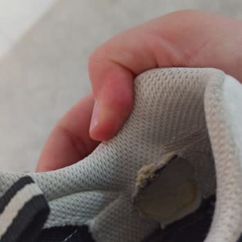 Garanti Süresi Dolmadan Ayakkabının Yırtılması Ve Mağaza Çözüm Sunmaması